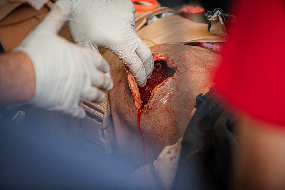 An image of an open wound, part of a training done by alumnus Rhys Williams, FNP
